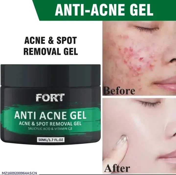 Fort Anti Acne Gel 50ml Scar Removal Cream